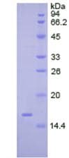 Rat Tryptase Protein (Recombinant His)