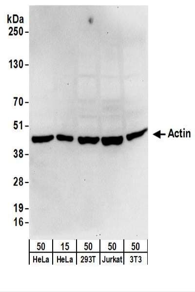 Polyclonal Rabbit anti-Human ACTG1 / Gamma Actin Antibody (N-Terminus, IHC, WB)