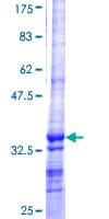 Human AMY1A / Salivary Amylase Protein (Recombinant GST, N-terminus)