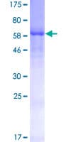 Human CD55 Protein (Recombinant GST)