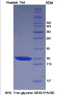 Rabbit THBD / CD141 / Thrombomodulin Protein (Recombinant His, N-Terminal)