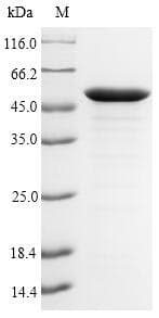 Pseudomonas aeruginosa lpxC / asmB / envA Protein (Recombinant 6His-SUMO, N-terminus)