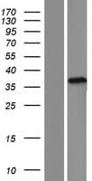 TEPP Protein (Over-Expression Lysate Myc-DDK (Flag))