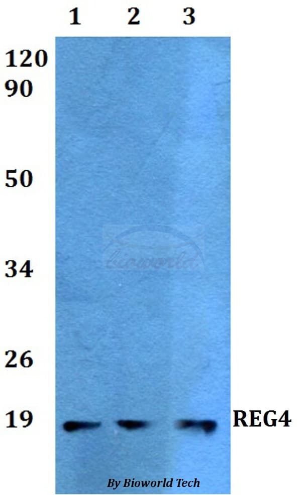 Polyclonal Rabbit anti-Human REG4 / REG-IV Antibody (WB)