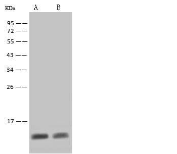 S100A8 / MRP8 Antibody (clone 203, Preservative Free)