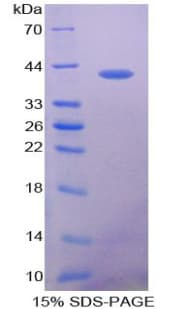 Human VCC-1 / CXCL17 Protein (Recombinant His-GST)