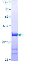 Human TGFBI Protein (Recombinant GST, N-terminus)