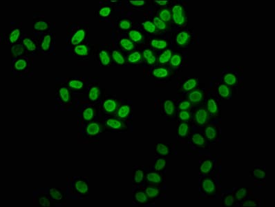 HIST1H4I Antibody