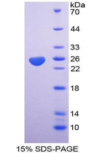 Mouse GC1qR / C1QBP Protein (Recombinant His)