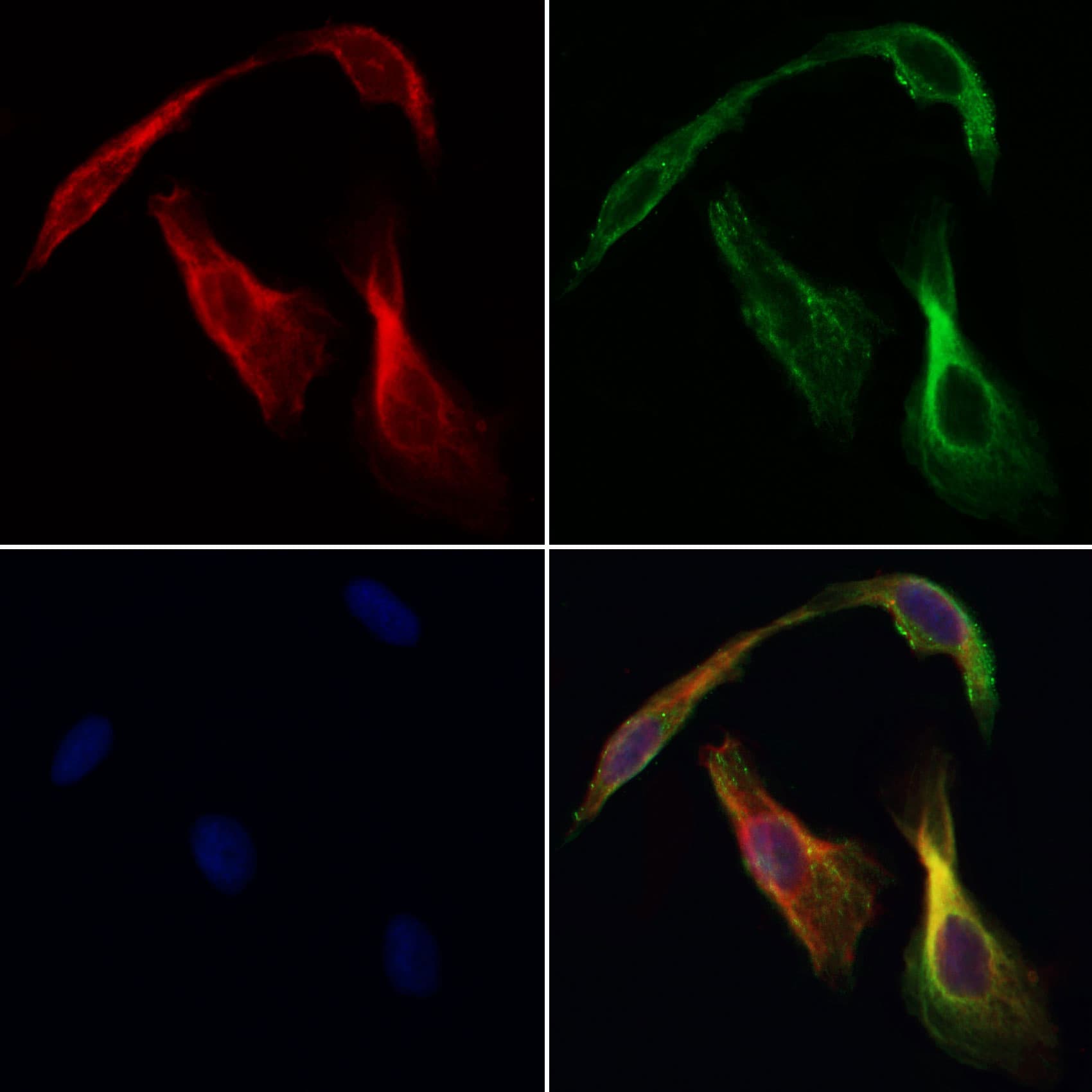 Polyclonal Rabbit anti-Human CHDH / CHD Antibody (IF, WB)