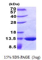 E. coli glpE Protein (Recombinant His)