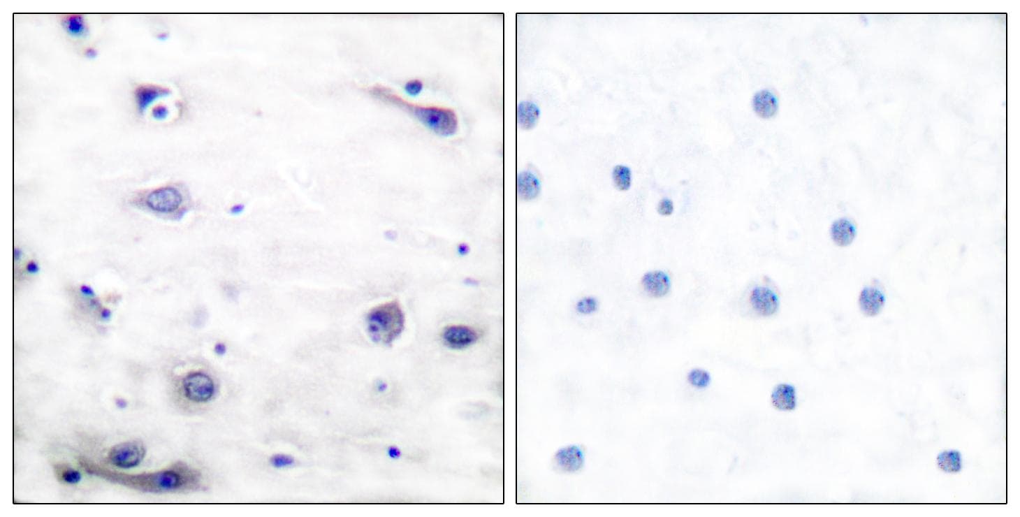 Polyclonal Rabbit anti-Human MAPT / Tau Antibody (phospho-Ser422, IHC, WB)