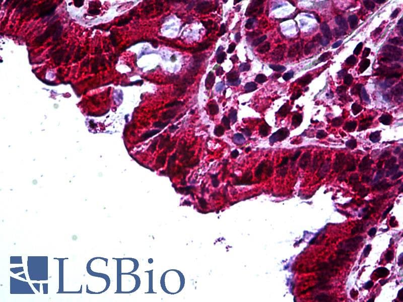 IHC-plus™ TAB2 Antibody (aa161-173)