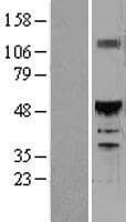 Human ONECUT1 / HNF6 Protein (Over-Expression Lysate Myc-DDK (Flag))