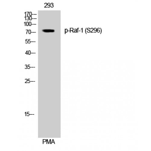 Polyclonal Rabbit anti-Human RAF1 / RAF Antibody (240-320 aa, IHC, WB)