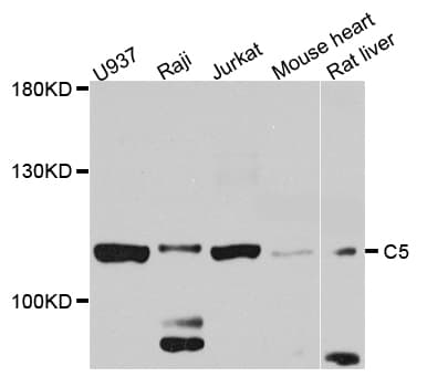 Polyclonal Rabbit anti-Human Complement C5 Antibody (IHC, WB)