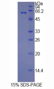 Human HRG Protein (Recombinant His-GST)