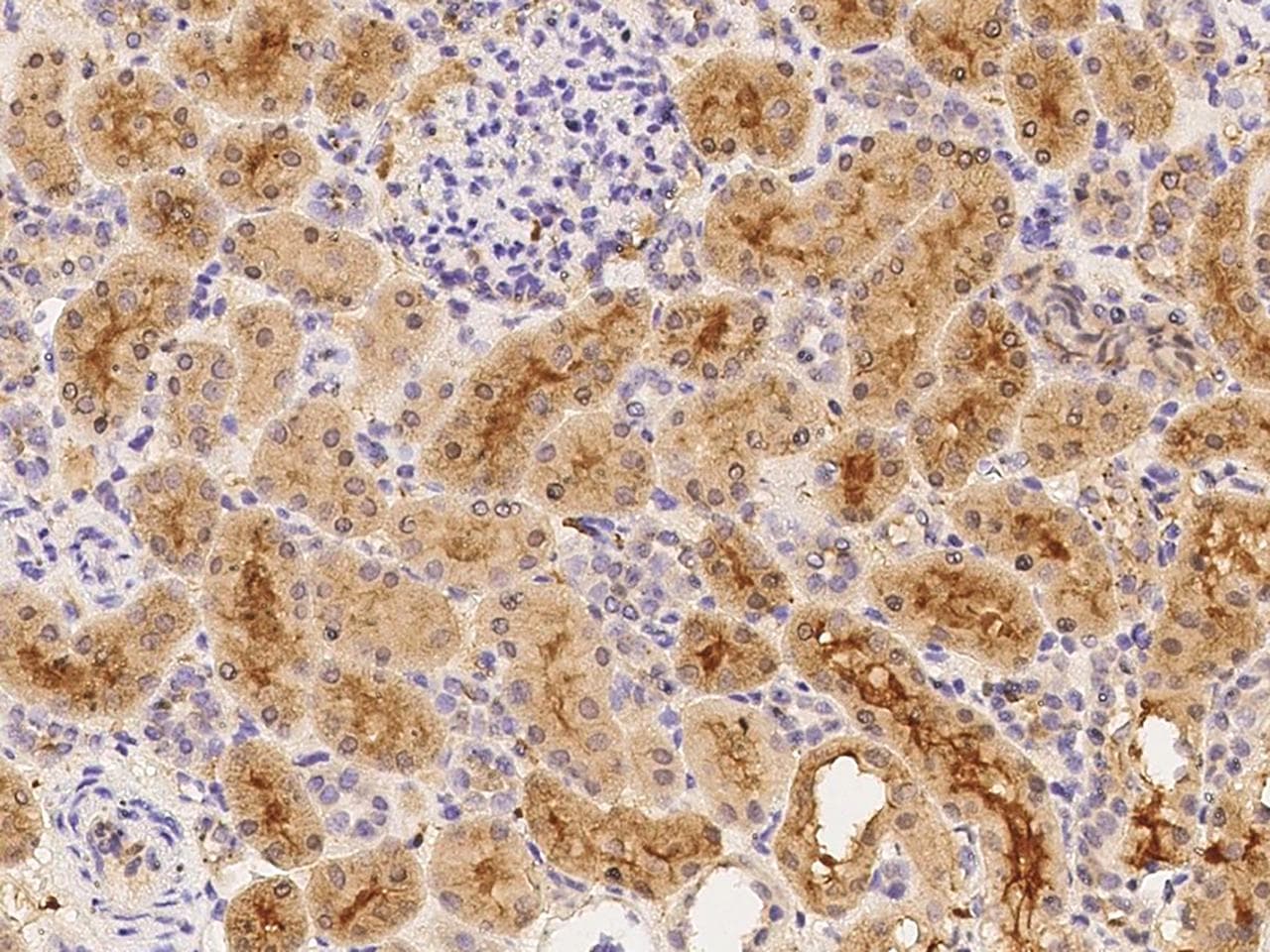 Polyclonal Rabbit anti-Human SFRP1 Antibody (Preservative Free, IHC)