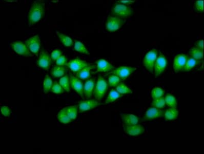 Polyclonal Rabbit anti-Human ELP2 / STATIP1 Antibody (IHC, IF)