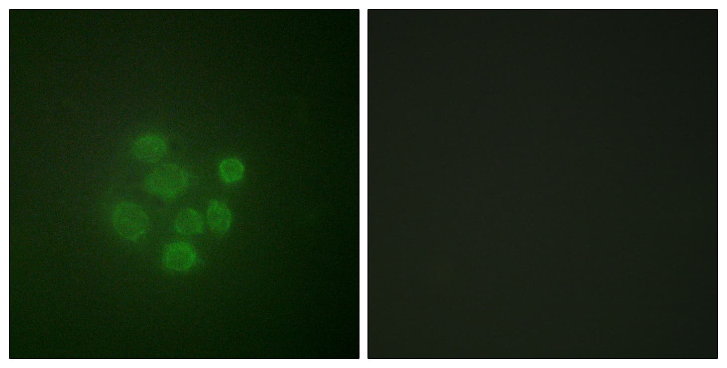 MDM2 Antibody (phospho-Ser166)