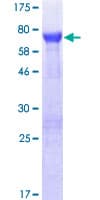 Human HGH1 / FAM203A Protein (Recombinant GST)