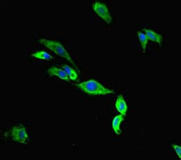 TMC2 Antibody