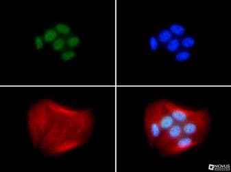 BRCA1 Antibody (aa1314-1864, clone RAY, Biotin)