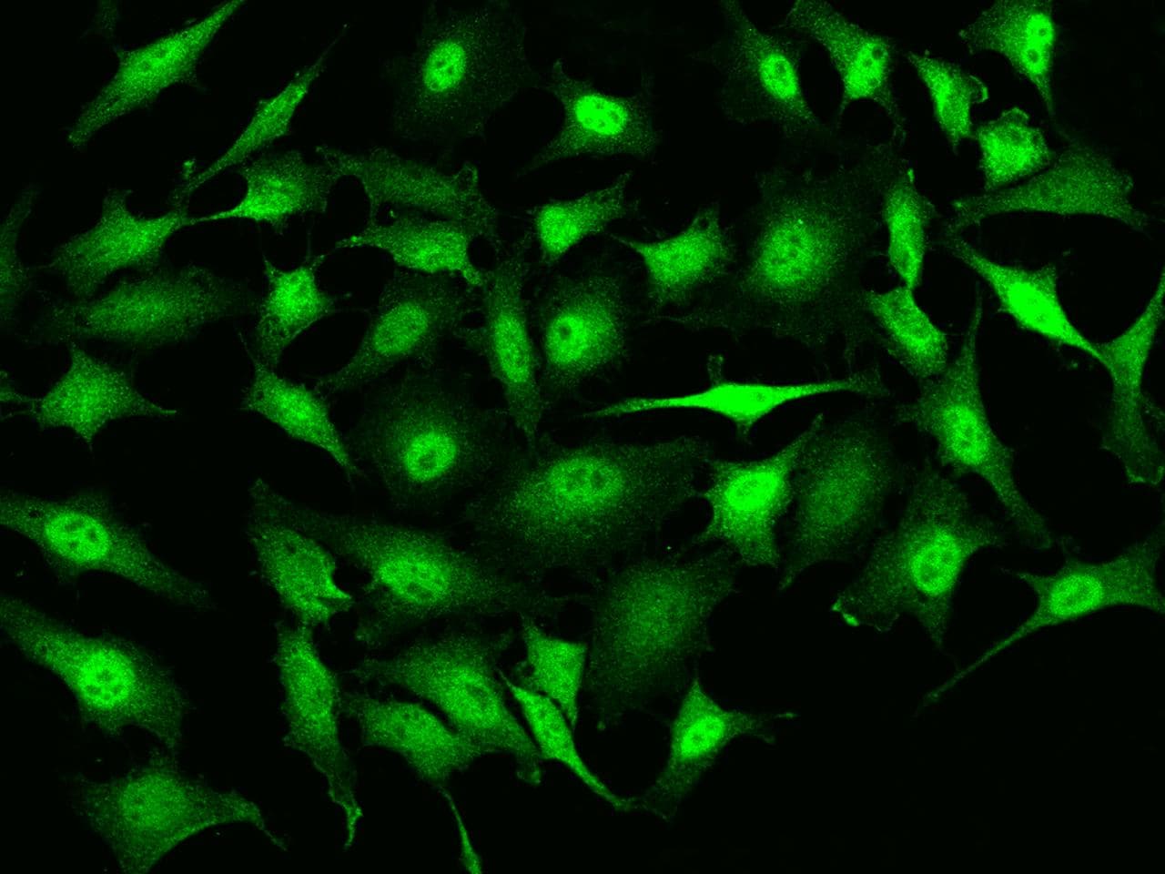 RMND5B Antibody