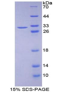 Mouse ATXN1 / SCA1 Protein (Recombinant His-T7)