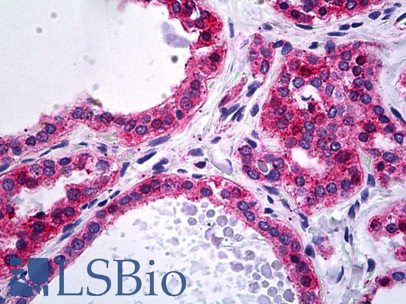 IHC-plus™ Monoclonal Mouse anti-Human ACTN4 Antibody (clone 4D10, IHC, IF, WB)