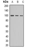 Polyclonal Rabbit anti-Human ACTN1 Antibody (N-Terminus, WB)