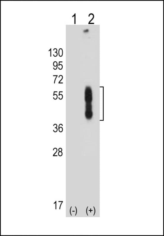 PD-L2 / PDCD1LG2 / CD273 Antibody (N-Terminus, clone 2011CT265.19.18)
