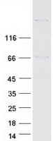 Human BRD8 Protein (Recombinant Myc-DDK (Flag))