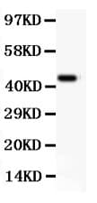 ITGAM / CD11b Antibody (aa17-382)
