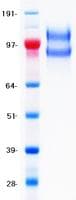 Human CD45 / LCA Protein (Recombinant DDK (Flag)-His, C-terminus)
