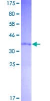 Human CYCS / Cytochrome c Protein (Recombinant GST)