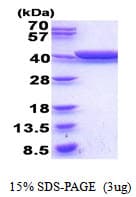 E. coli gldA Protein (Recombinant His)