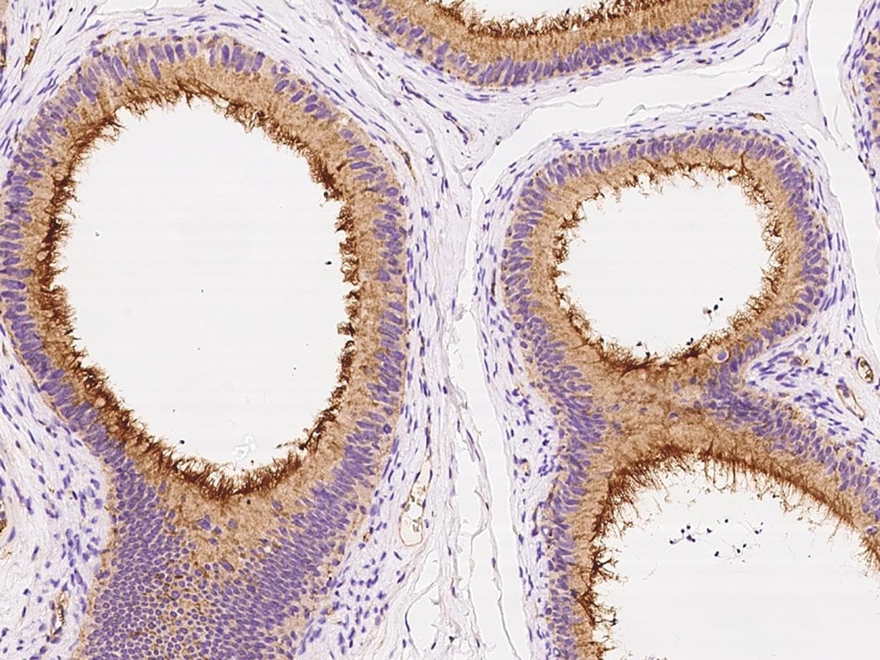 Polyclonal Rabbit anti-Human TEM7 Antibody (IHC)