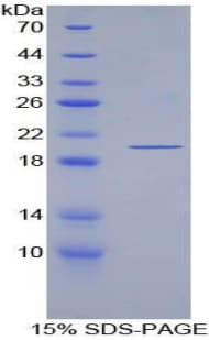 eco / Ecotin Protein (Recombinant His, N-Terminal)