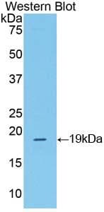 CRH / CRF Antibody (aa40-195, PE)