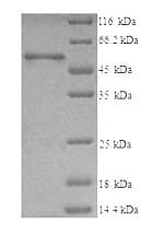 Human CCT2 / CCT Beta Protein (Recombinant 6His, N-terminus)