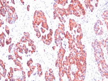 Basic Cytokeratin Antibody (clone SPM116)