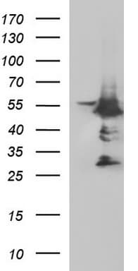 MYC / c-Myc Antibody (clone OTI5E9G2, Carrier-free)