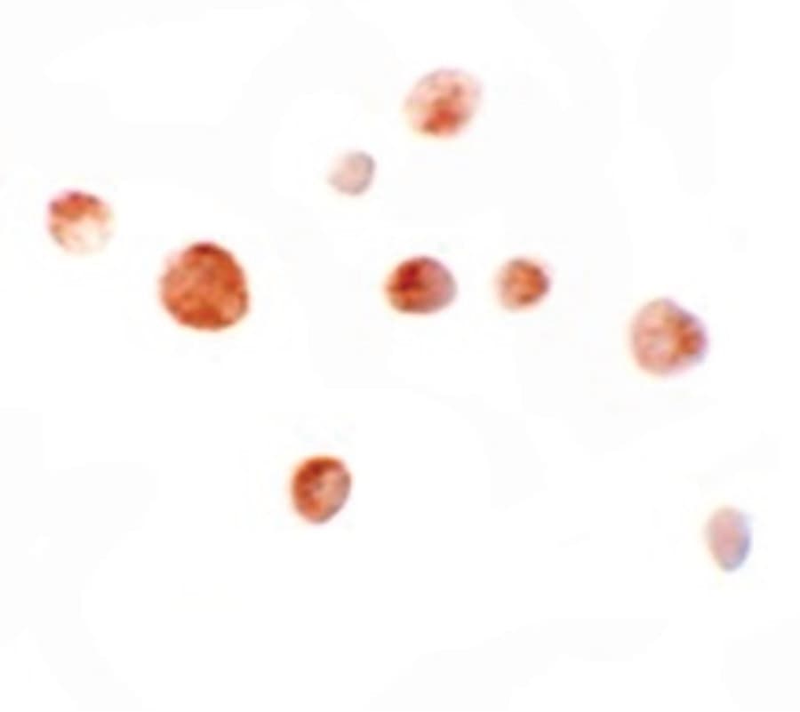 ZMIZ1 Antibody