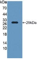 LCP1 / L-Plastin Antibody (aa5-233)