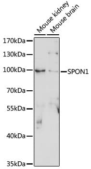 Polyclonal Rabbit anti-Human SPON1 / F-Spondin Antibody (WB)