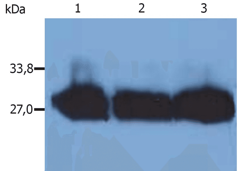 Mouse Anti-Human Kappa Light Chain Secondary Antibody (clone MEM-09)