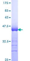 Human MYOD / MYOD1 Protein (Recombinant GST, N-terminus)