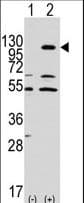 Polyclonal Rabbit anti-Human EPHA7 / EPH Receptor A7 Antibody (IHC, WB)