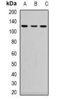 NRP2 / Neuropilin 2 Antibody (Internal)